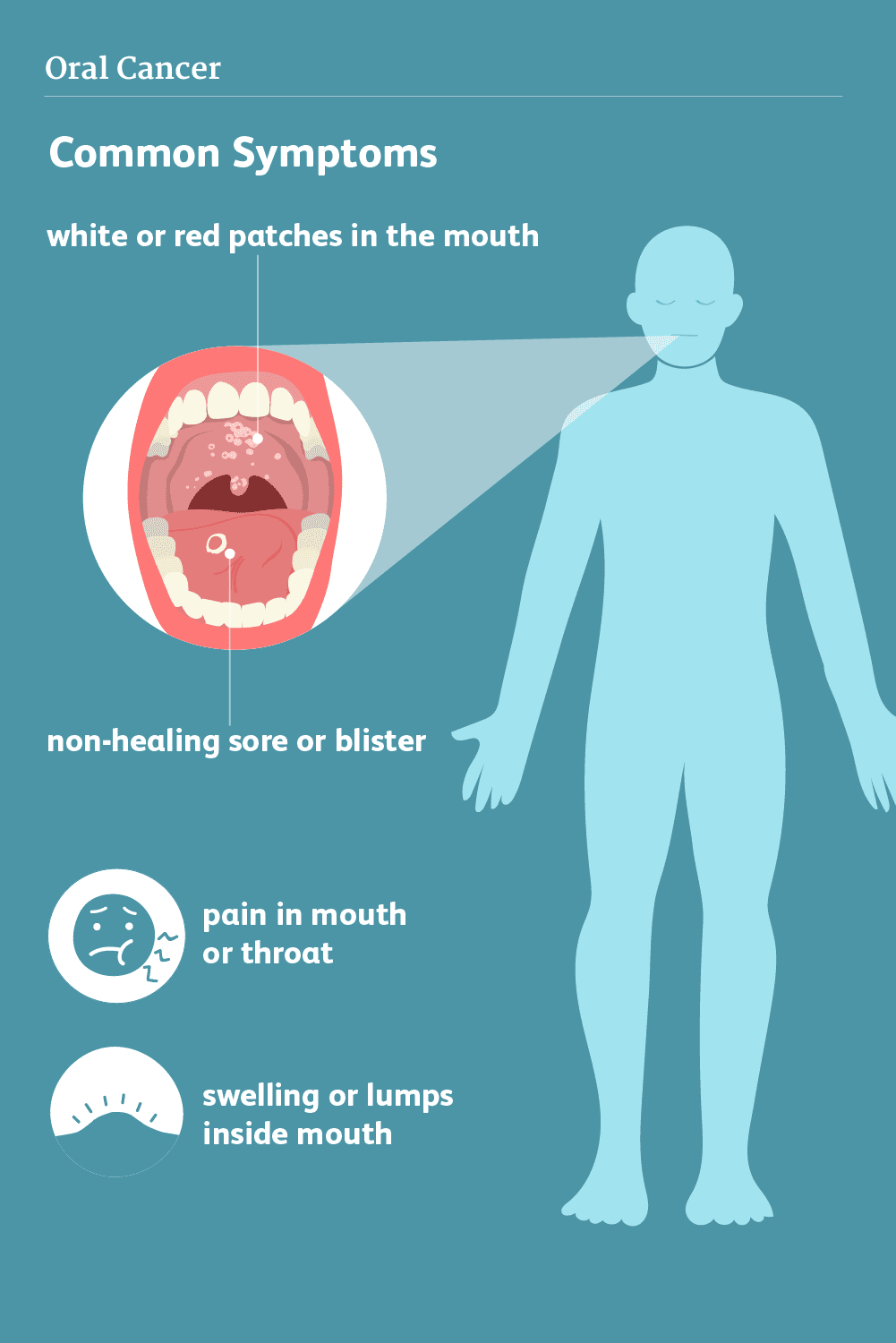 oral-cancer-treatment-in-punjab-mouth-cancer-treatment-cost-in-ludhiana